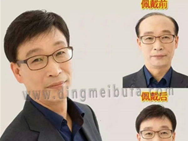 男士補發價格