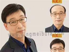 為什么有的男士發型很酷炫，那是做了補發哦