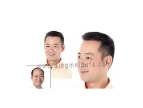 禿頂了也可以做假發嗎?南陽假發公司告訴你