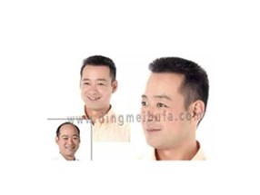 脫發人的中年危機只是偽命題 教你如何一招解決形象尷尬！