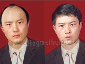 使用假發的禁忌有哪些？