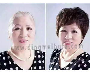 蓋白發發片